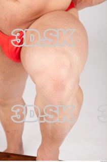 Knee texture of Gene 0002